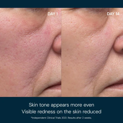 Dynamic Resurfacing Facial Pads - 60 Pads Image 4