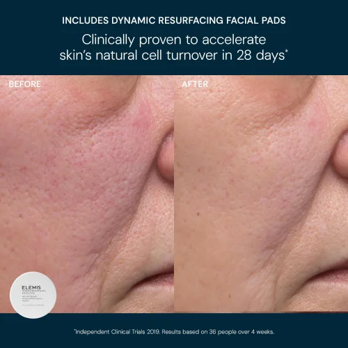 Glow Bright Resurfacing Duo Image 4